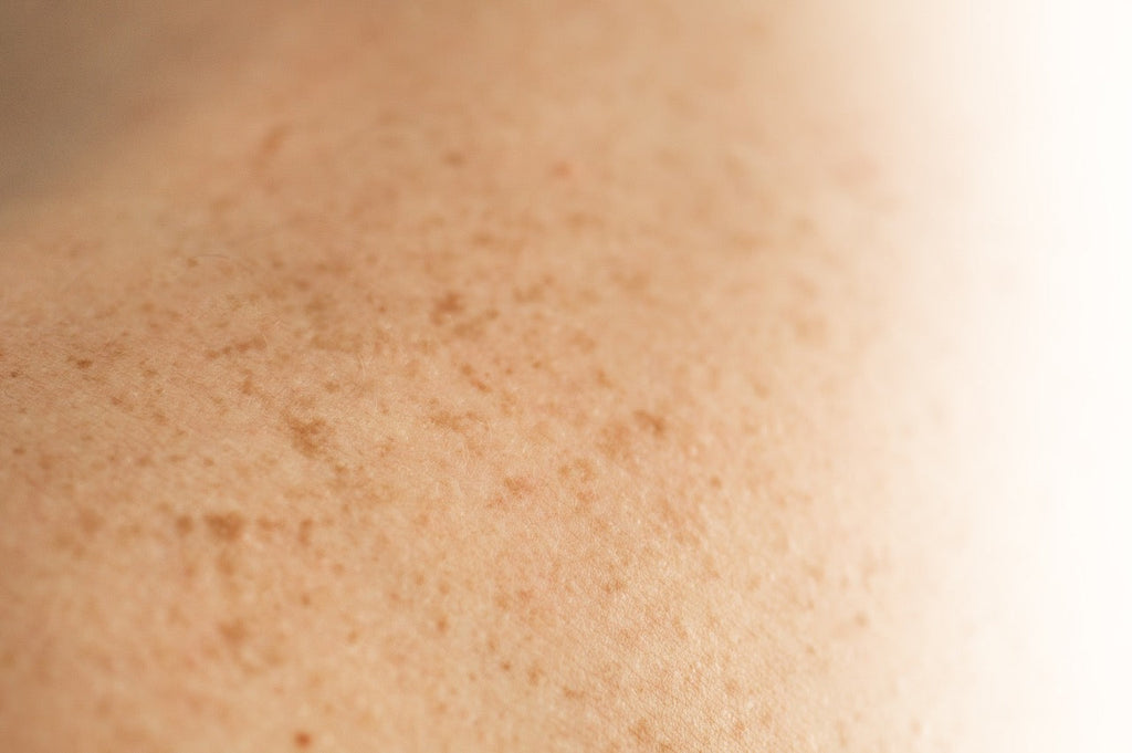 Sérum com Ácido Glicólico: O Guia para Melhorar a Textura Corporal